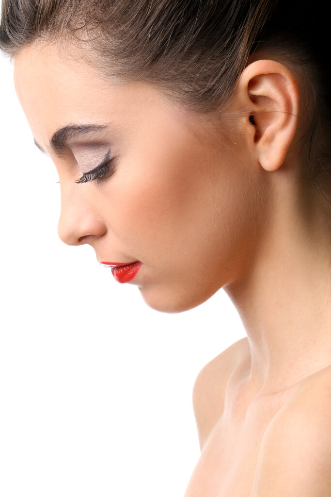 Before and after rhinoplasty by Dr. JC Alvarez – Miami’s top nose reshaping expert.