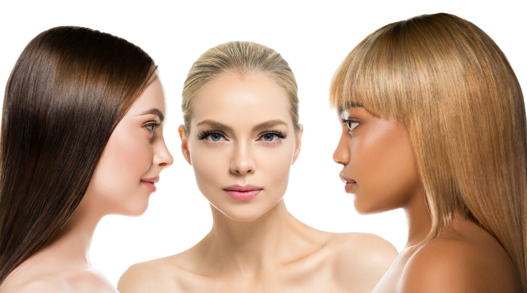 Before and after rhinoplasty by Dr. JC Alvarez – Miami’s top nose reshaping expert.