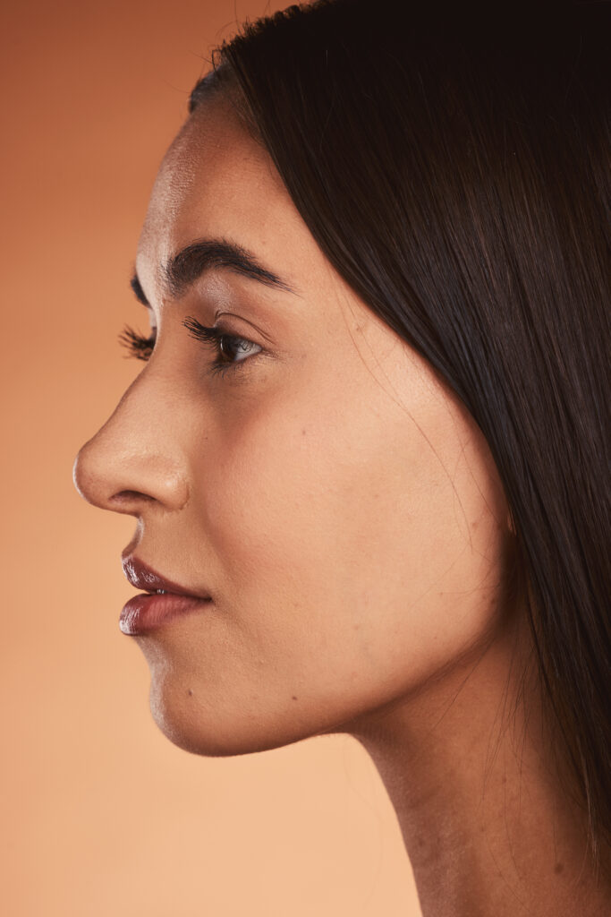 Before and after rhinoplasty by Dr. JC Alvarez – Miami’s top nose reshaping expert.